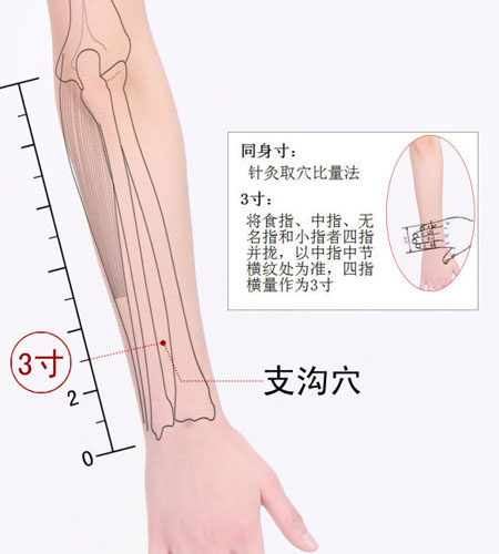 支沟穴→降逆通腑