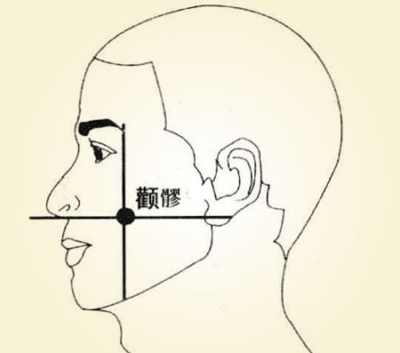 颧髎穴→清热消肿