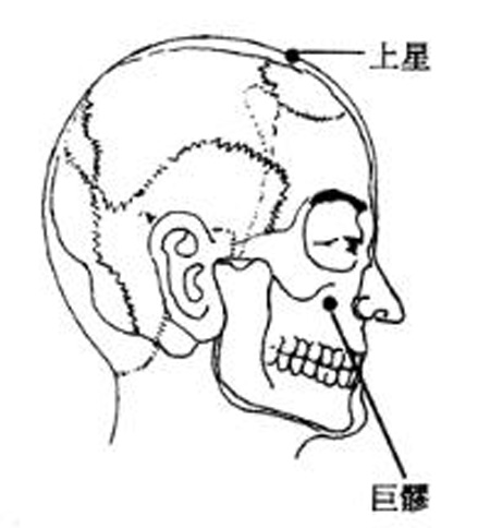 巨髎穴→清热息风