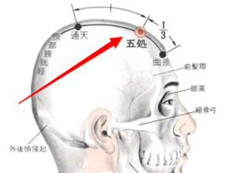 五处穴→清热散风