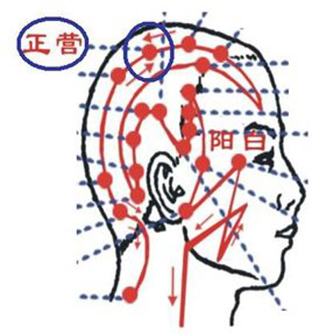 正营穴→治头痛、头晕