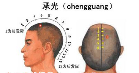 承光穴→治头痛、鼻炎