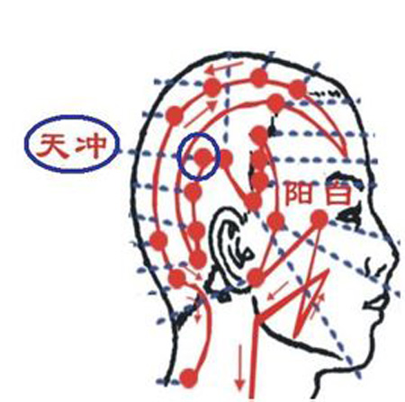 天冲穴→治头痛、齿痛