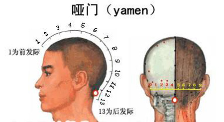 哑门穴→治音哑、头痛