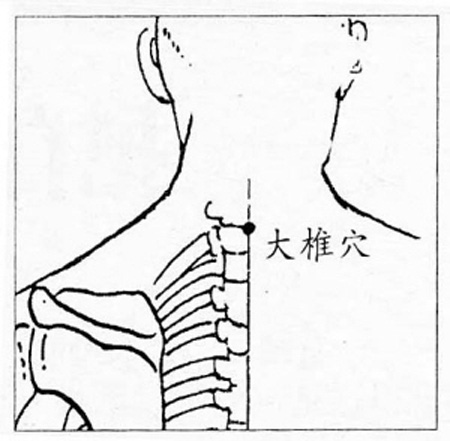 大椎穴→清热解表