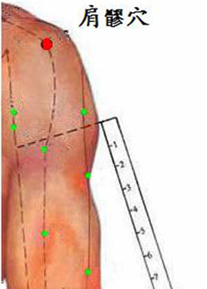 肩髎穴→缓解肩臂疼痛
