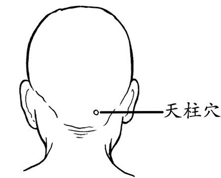 天柱穴→治头痛、项强