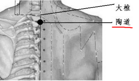 陶道穴→治头痛项强