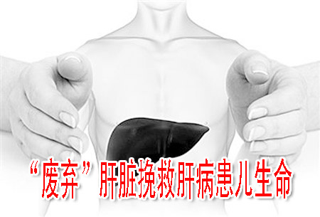“废弃”肝脏挽救肝病患儿生命