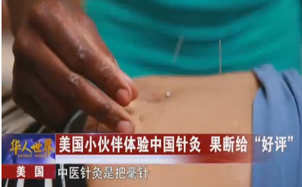 美国小伙伴体验中国针灸，果断给“好评”