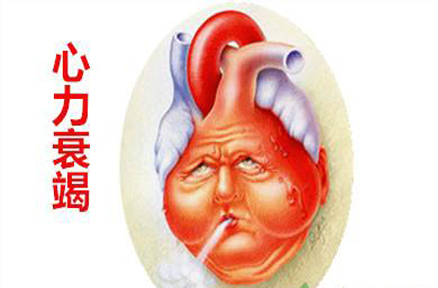心力衰竭是由于心脏因疾病,过劳,排血功能减弱,以至排血量不能满足