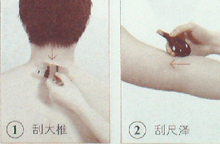 中暑用刮痧疗法