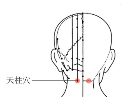 天柱穴