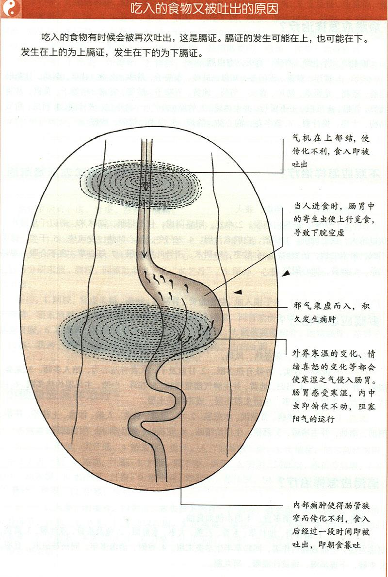 呕吐应怎样治疗？