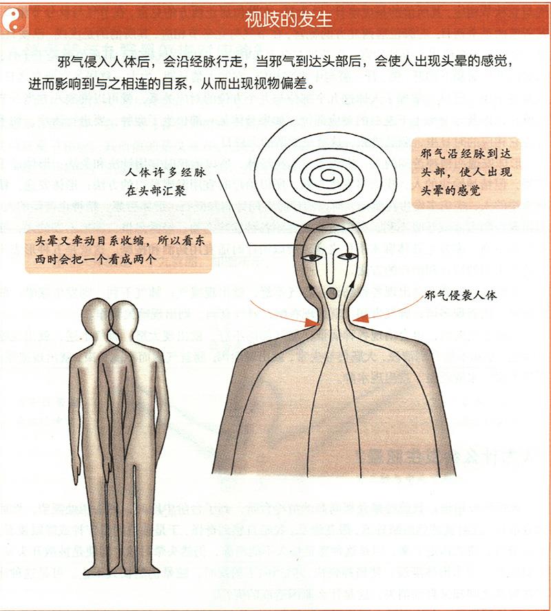 人为什么会发生眩晕？